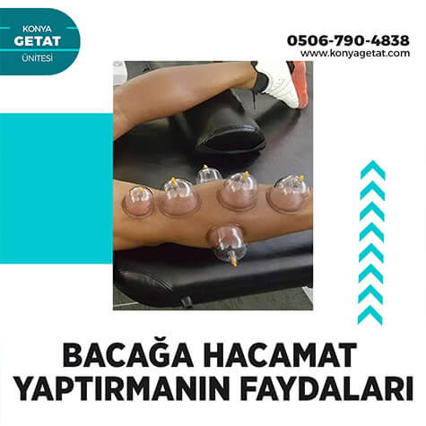 Bacağa Hacamat Yaptırmanın Faydaları
