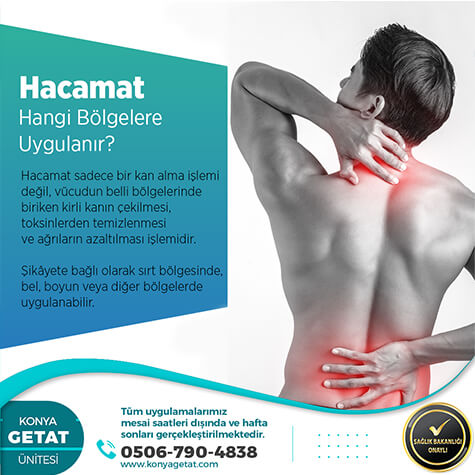 Konya Hacamat Yapanlar
