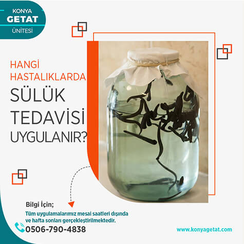 Hangi Hastalıklarda Sülük Tedavisi Uygulanır?
