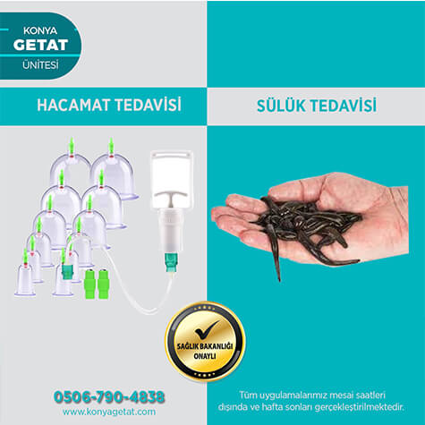 Hacamat ve Sülük Tedavisi