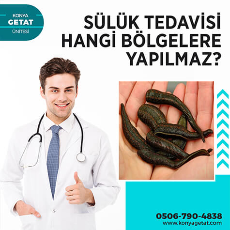 Sülük Tedavisi Hangi Bölgelere Yapılmaz?