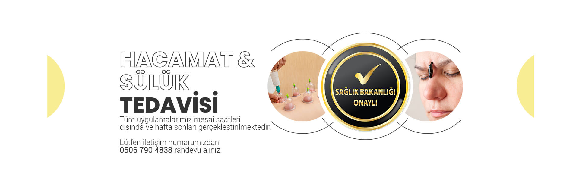 hacamat ve sülük tedavisi ONAYLI